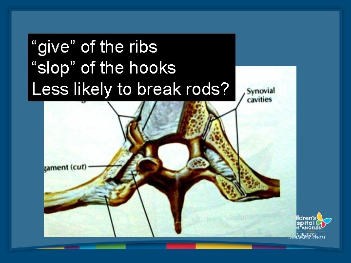 “give” of the ribs “slop” of the hooks Less likely to break rods? 