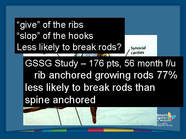 “give” of the ribs “slop” of the hooks Less likely to break rods? GSSG