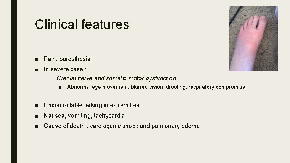 Clinical features ■ Pain, paresthesia ■ In severe case : – Cranial nerve and