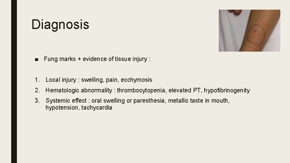 Diagnosis ■ Fung marks + evidence of tissue injury : 1. Local injury :