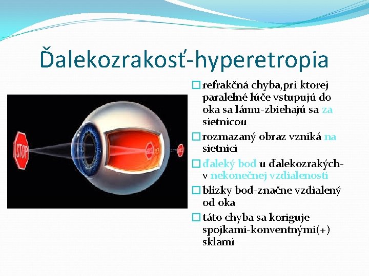 Ďalekozrakosť-hyperetropia �refrakčná chyba, pri ktorej paralelné lúče vstupujú do oka sa lámu-zbiehajú sa za