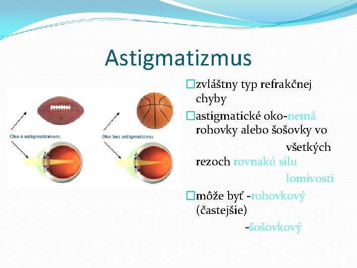 Astigmatizmus �zvláštny typ refrakčnej chyby �astigmatické oko-nemá rohovky alebo šošovky vo všetkých rezoch rovnakú