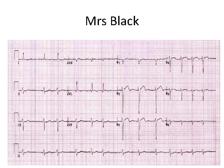 Mrs Black 