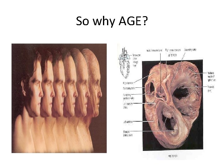 So why AGE? 