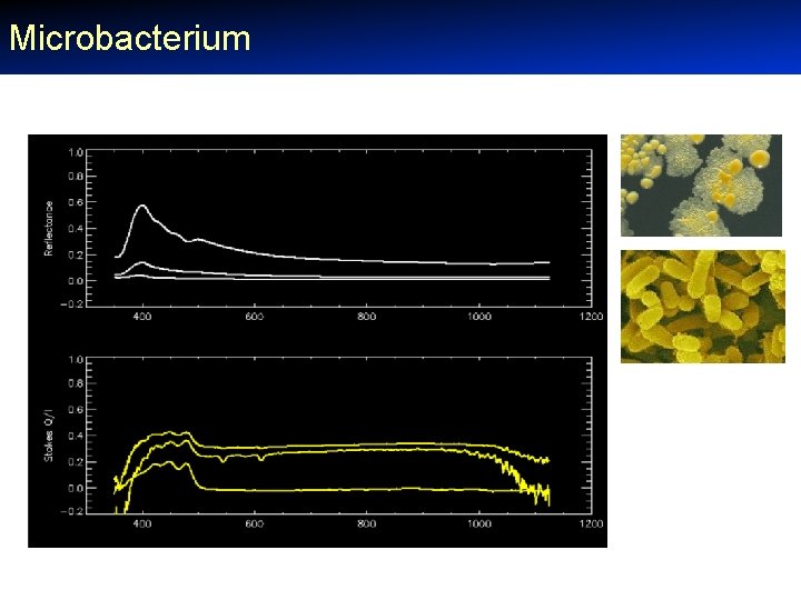 Microbacterium 