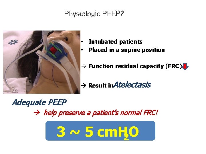 Physiologic PEEP? • Intubated patients • Placed in a supine position à Function residual