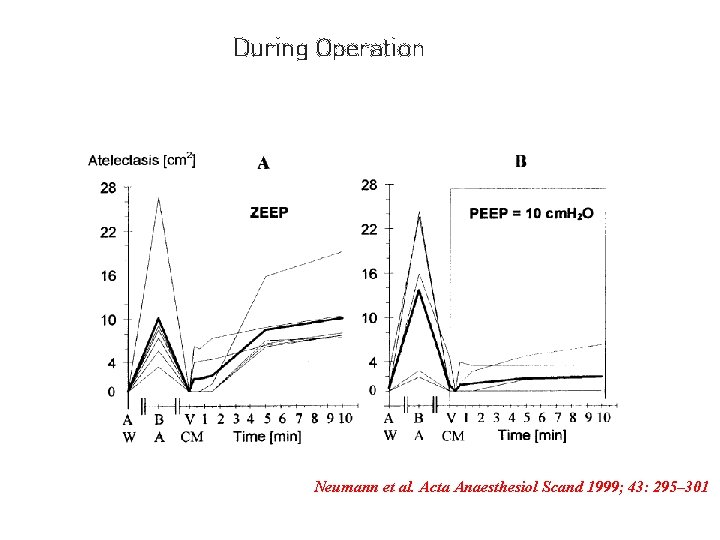 During Operation Neumann et al. Acta Anaesthesiol Scand 1999; 43: 295– 301 