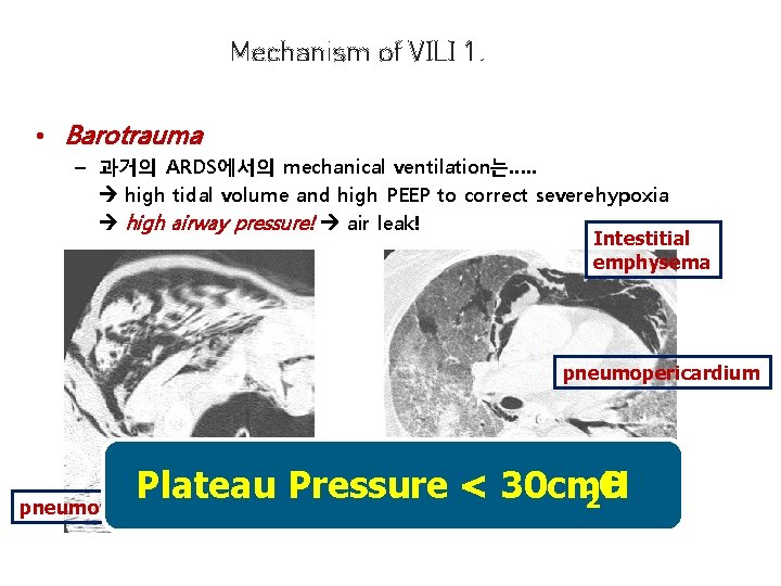 Basic Concepts of Mechanical Ventilation Sang Heon Park