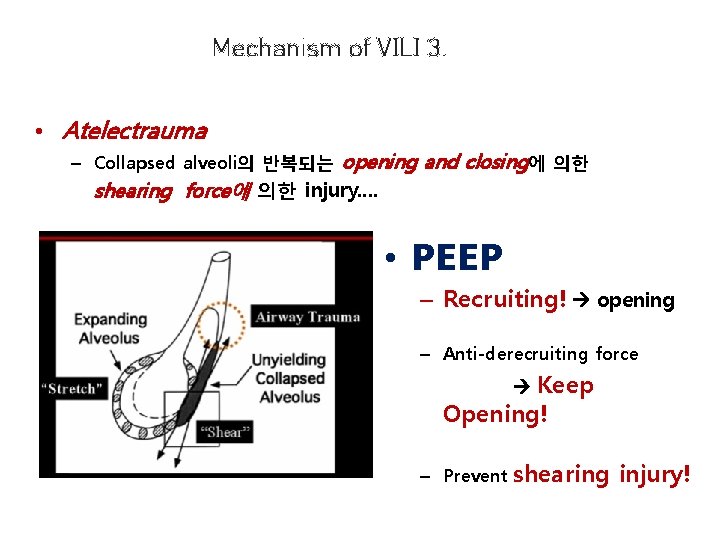 Mechanism of VILI 3. • Atelectrauma – Collapsed alveoli의 반복되는 opening and closing에 의한