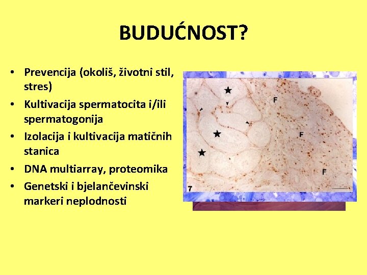 BUDUĆNOST? • Prevencija (okoliš, životni stil, stres) • Kultivacija spermatocita i/ili spermatogonija • Izolacija