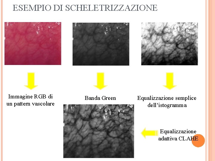 ESEMPIO DI SCHELETRIZZAZIONE Immagine RGB di un pattern vascolare Banda Green Equalizzazione semplice dell’istogramma