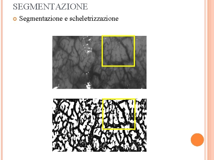 SEGMENTAZIONE Segmentazione e scheletrizzazione 