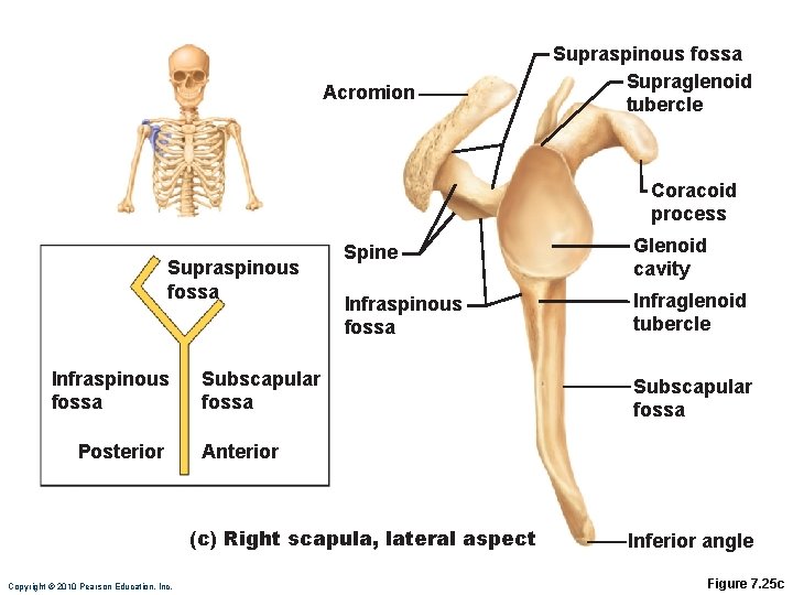 Acromion Supraspinous fossa Supraglenoid tubercle Coracoid process Supraspinous fossa Infraspinous fossa Posterior Spine Glenoid