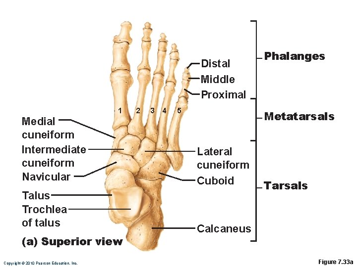 Distal Middle Proximal 1 Medial cuneiform Intermediate cuneiform Navicular Talus Trochlea of talus (a)