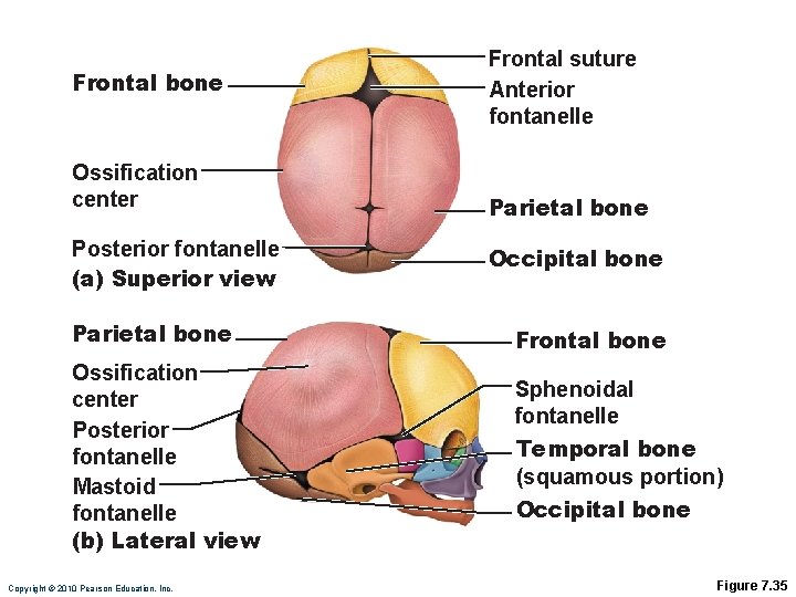 Frontal bone Ossification center Posterior fontanelle (a) Superior view Parietal bone Ossification center Posterior
