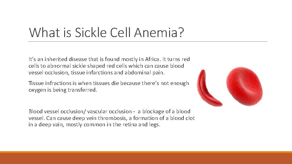 What is Sickle Cell Anemia? It’s an inherited disease that is found mostly in