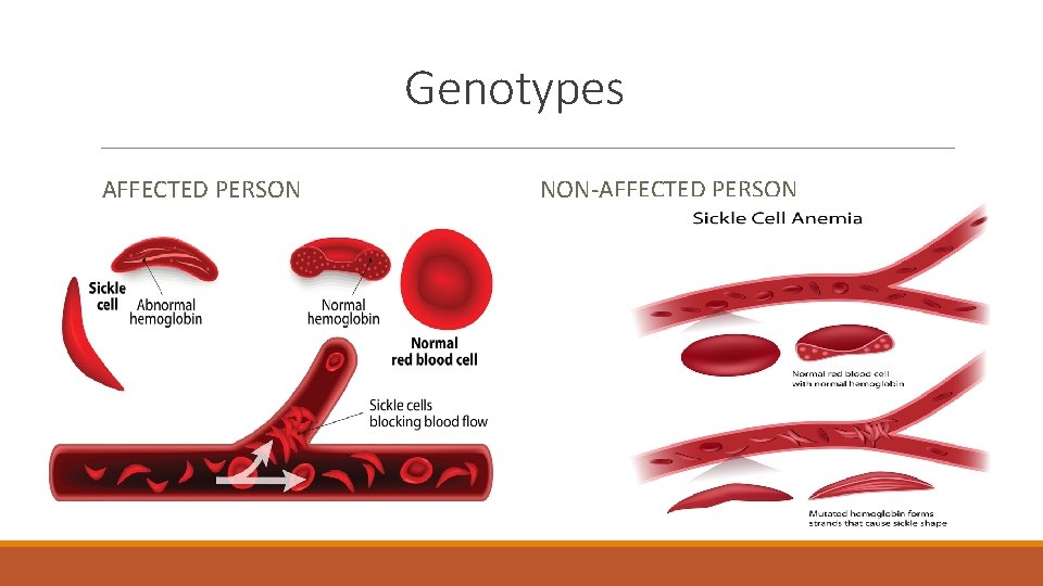 Genotypes AFFECTED PERSON NON-AFFECTED PERSON 