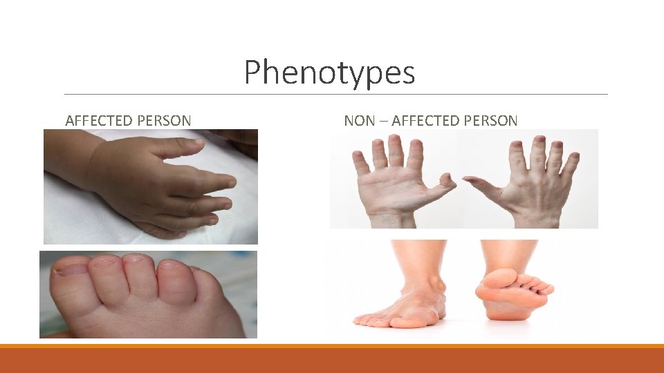 Phenotypes AFFECTED PERSON NON – AFFECTED PERSON 