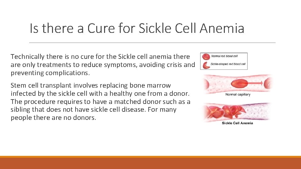 Is there a Cure for Sickle Cell Anemia Technically there is no cure for