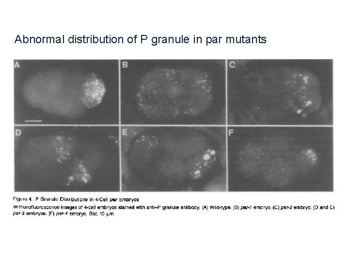 Abnormal distribution of P granule in par mutants 