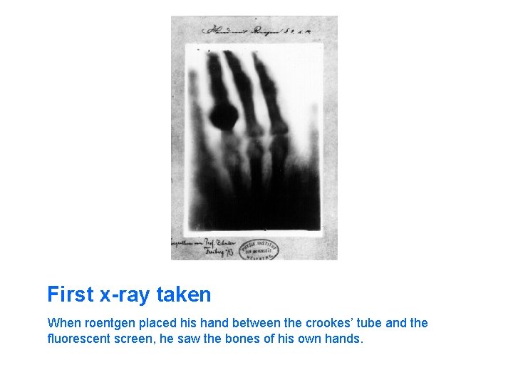 First x-ray taken When roentgen placed his hand between the crookes’ tube and the