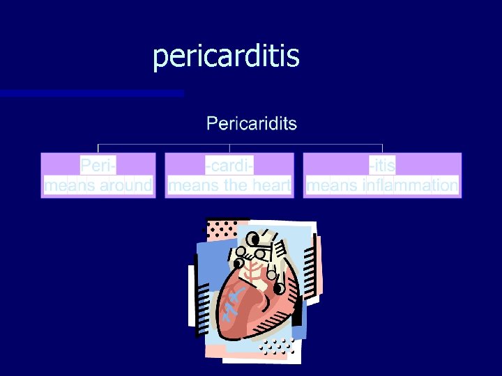 pericarditis 