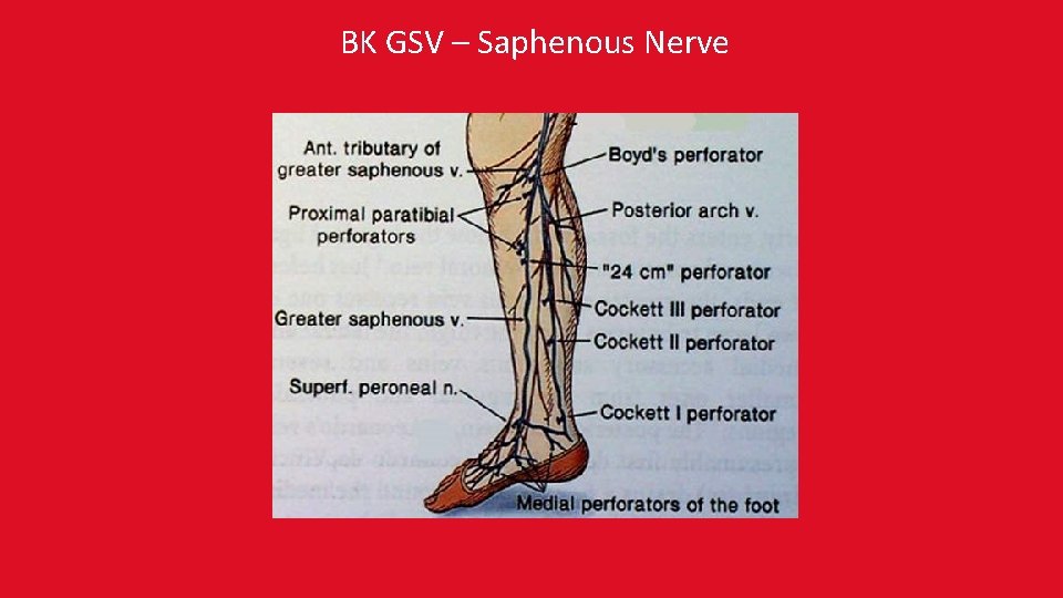 BK GSV – Saphenous Nerve 
