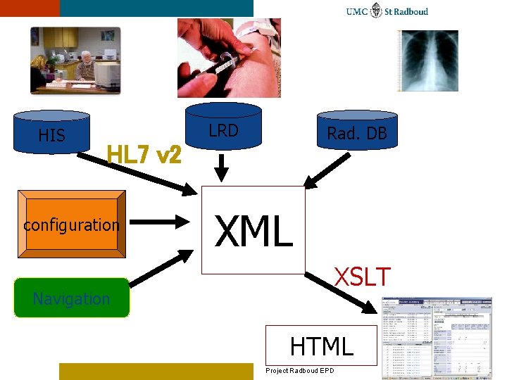 HIS LRD Rad. DB HL 7 v 2 configuration Navigation XML XSLT HTML Project