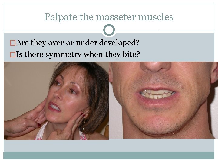 Palpate the masseter muscles �Are they over or under developed? �Is there symmetry when