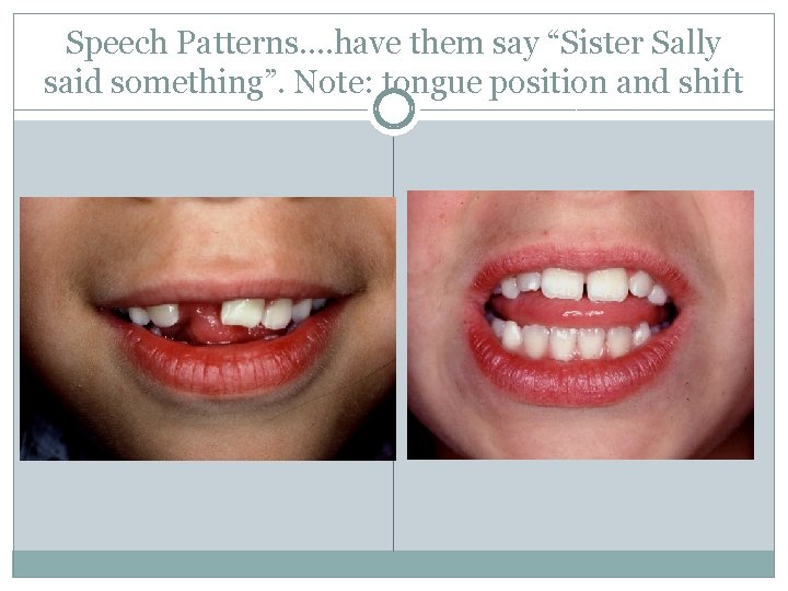 Speech Patterns…. have them say “Sister Sally said something”. Note: tongue position and shift