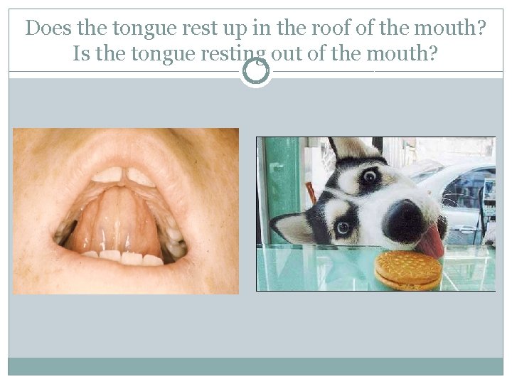 Does the tongue rest up in the roof of the mouth? Is the tongue