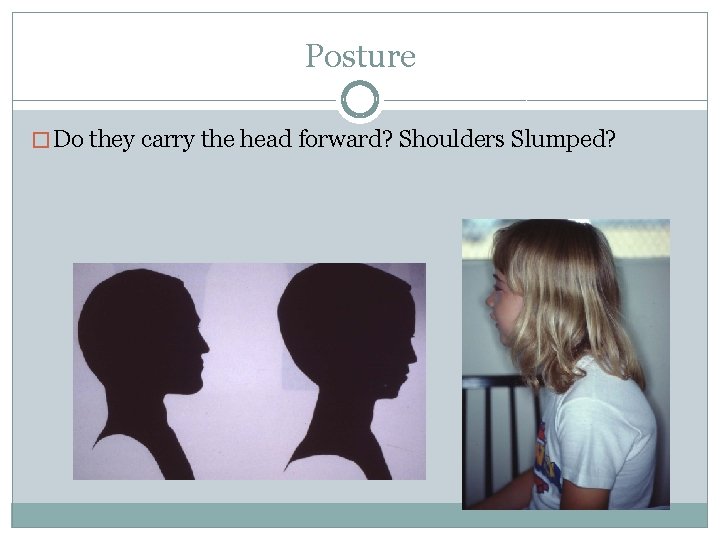 Posture � Do they carry the head forward? Shoulders Slumped? 