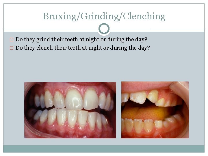 Bruxing/Grinding/Clenching � Do they grind their teeth at night or during the day? �