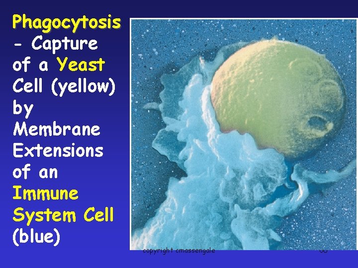 Phagocytosis - Capture of a Yeast Cell (yellow) by Membrane Extensions of an Immune