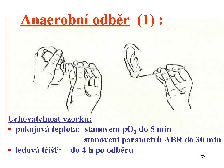 Anaerobní odběr (1) : Uchovatelnost vzorků: • pokojová teplota: stanovení p. O 2 do