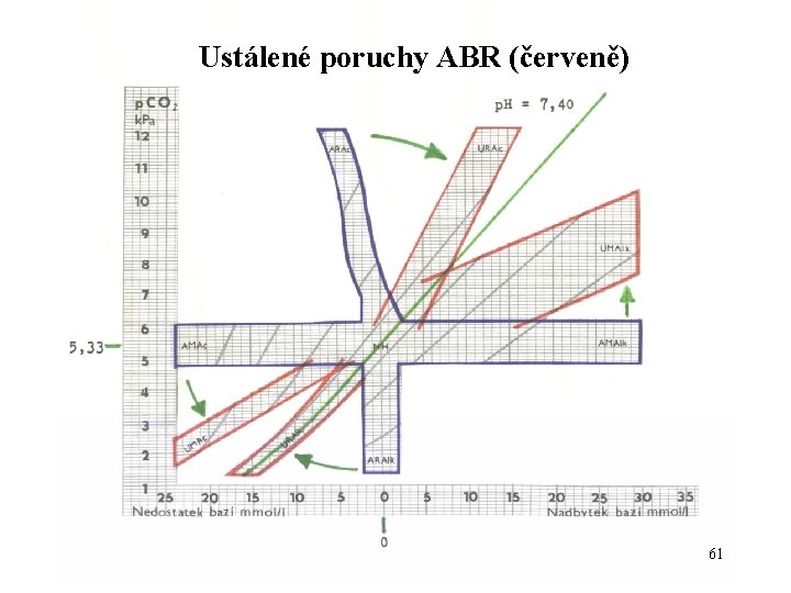 Ustálené poruchy ABR (červeně) 61 