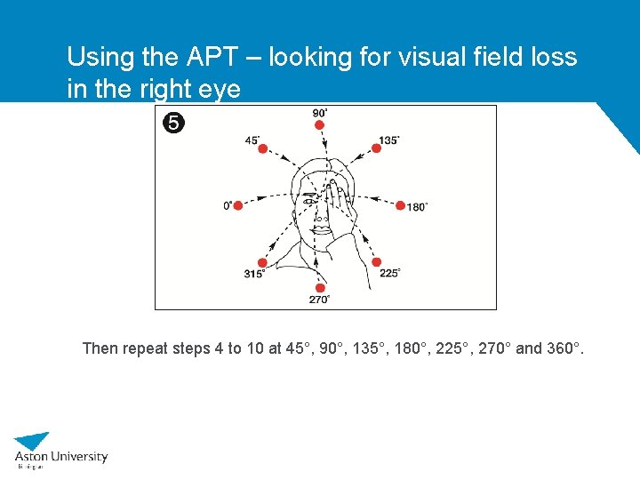 Using the APT – looking for visual field loss in the right eye Then