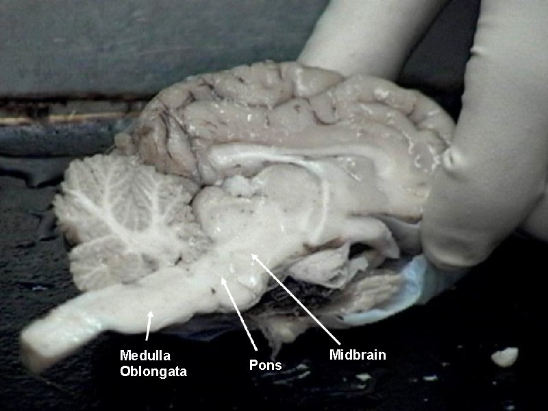 Medulla Oblongata Pons Midbrain 