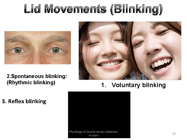 Lid Movements (Blinking) 2. Spontaneous blinking: (Rhythmic blinking) 1. Voluntary blinking 3. Reflex blinking