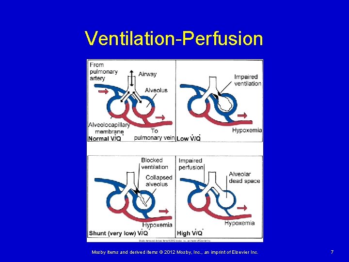 Ventilation-Perfusion Mosby items and derived items © 2012 Mosby, Inc. , an imprint of Ventilation-Perfusion Mosby items and derived items © 2012 Mosby, Inc. , an imprint of
