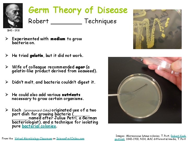 Germ Theory of Disease Robert ____ Techniques 1843 - 1910 Ø Experimented with medium