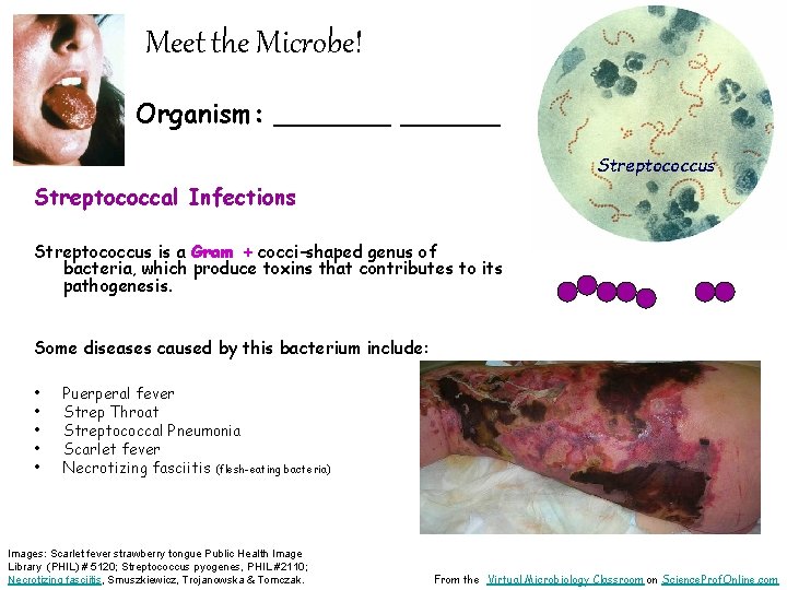 Meet the Microbe! Organism: _______ Streptococcus Streptococcal Infections Streptococcus is a Gram + cocci-shaped