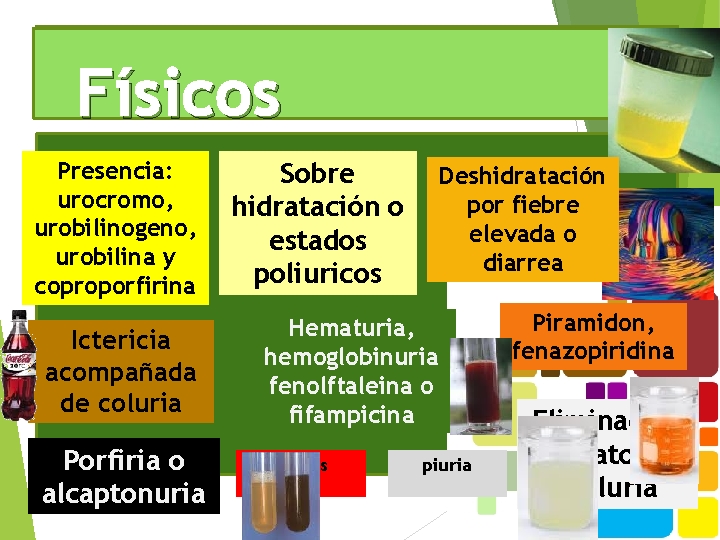 Físicos Presencia: urocromo, urobilinogeno, urobilina y coproporfirina Ictericia acompañada de coluria Porfiria o alcaptonuria