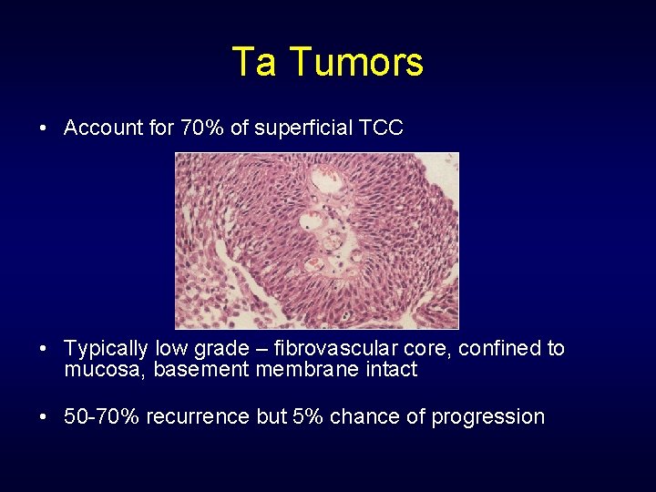 Ta Tumors • Account for 70% of superficial TCC • Typically low grade –