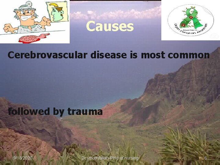 Causes Cerebrovascular disease is most common followed by trauma 9/18/2020 Dr. yekehfallah-PHd of nursing