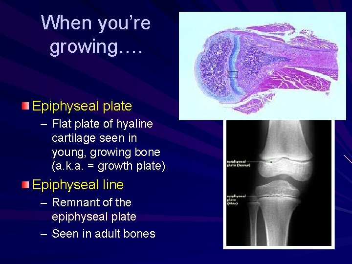 When you’re growing…. Epiphyseal plate – Flat plate of hyaline cartilage seen in young,