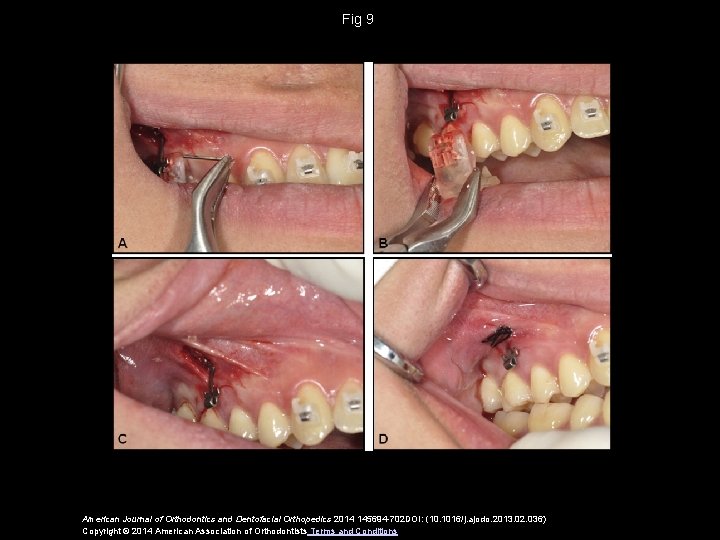 Fig 9 American Journal of Orthodontics and Dentofacial Orthopedics 2014 145694 -702 DOI: (10.