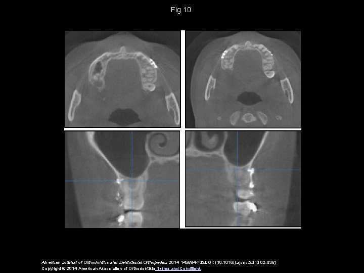 Fig 10 American Journal of Orthodontics and Dentofacial Orthopedics 2014 145694 -702 DOI: (10.