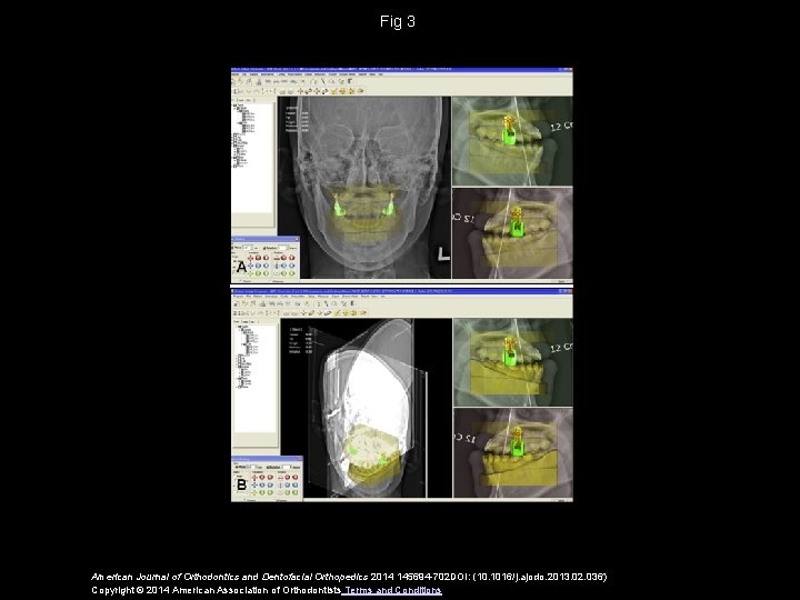 Fig 3 American Journal of Orthodontics and Dentofacial Orthopedics 2014 145694 -702 DOI: (10.
