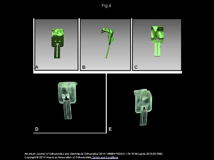 Fig 4 American Journal of Orthodontics and Dentofacial Orthopedics 2014 145694 -702 DOI: (10.